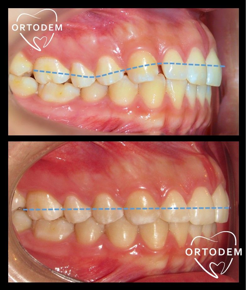 Elizabeth Morelos Morales-19
