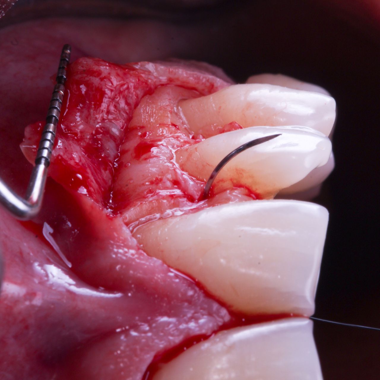 Hugo Enrique Aguilar Lamas-99