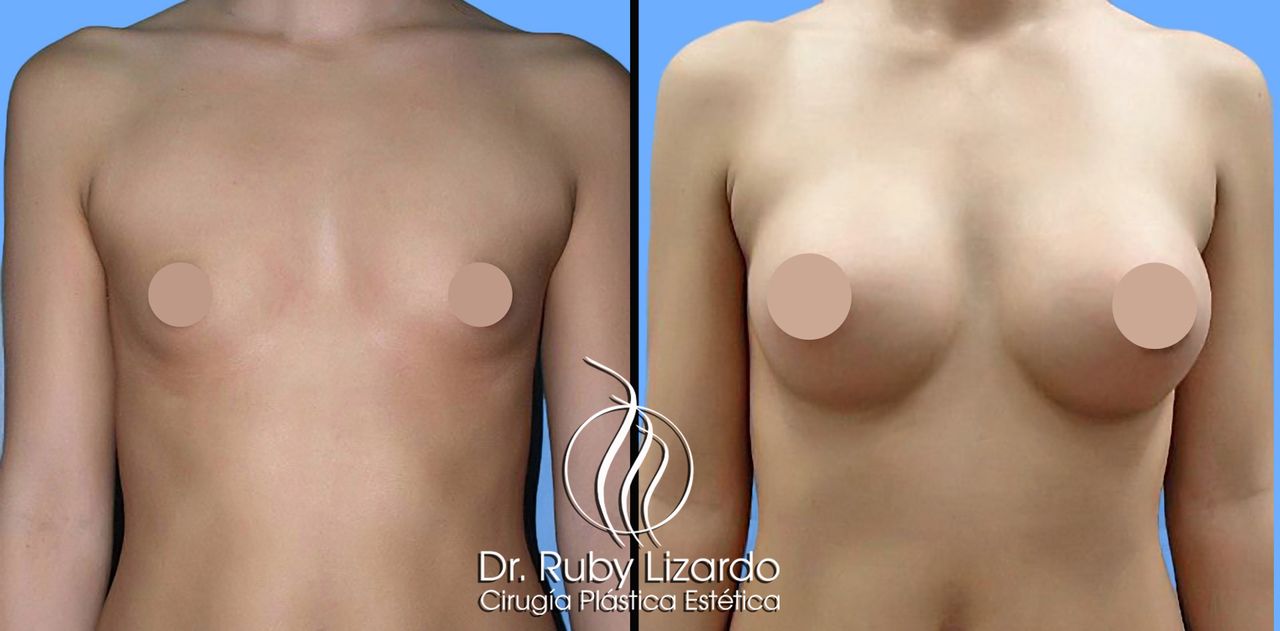 Ruby Lizardo Ramírez Robles-22