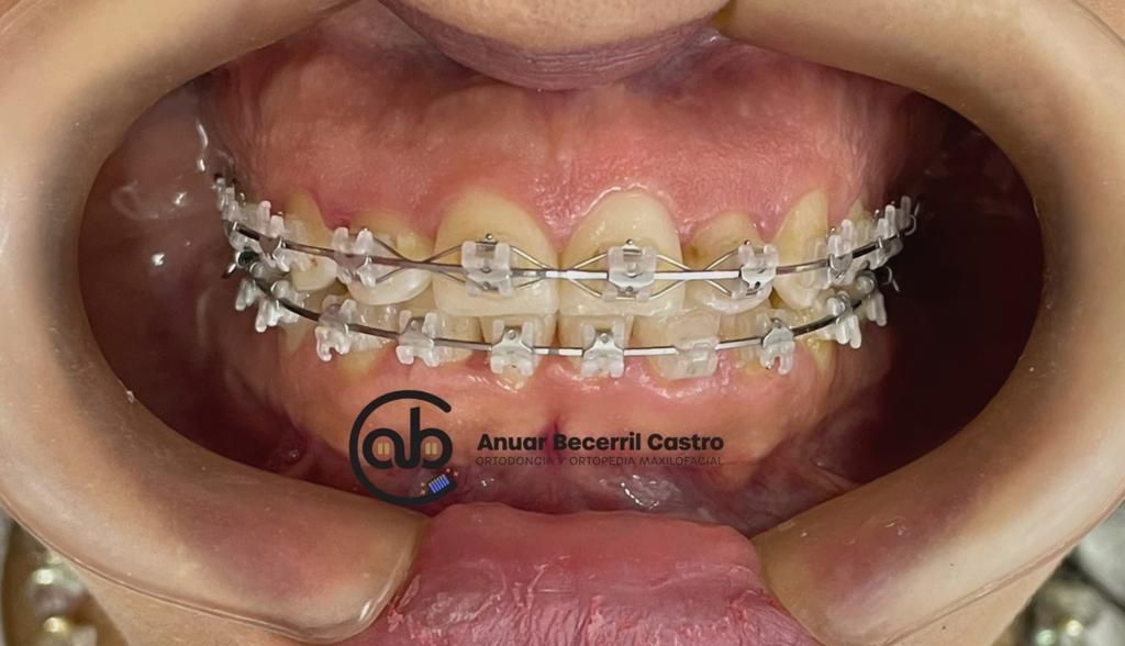 Anuar Becerril Castro-29