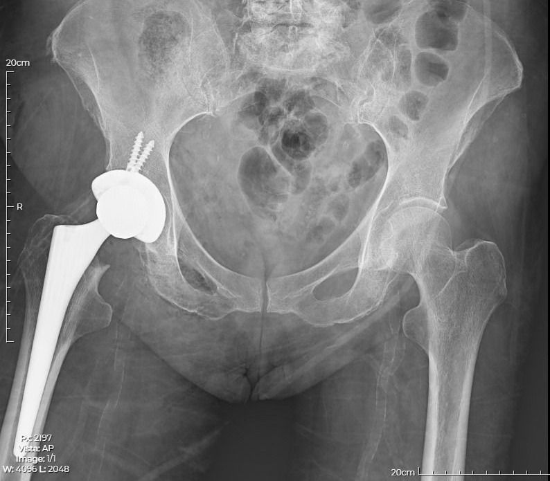 Luis Fernando Rodríguez Mata-3