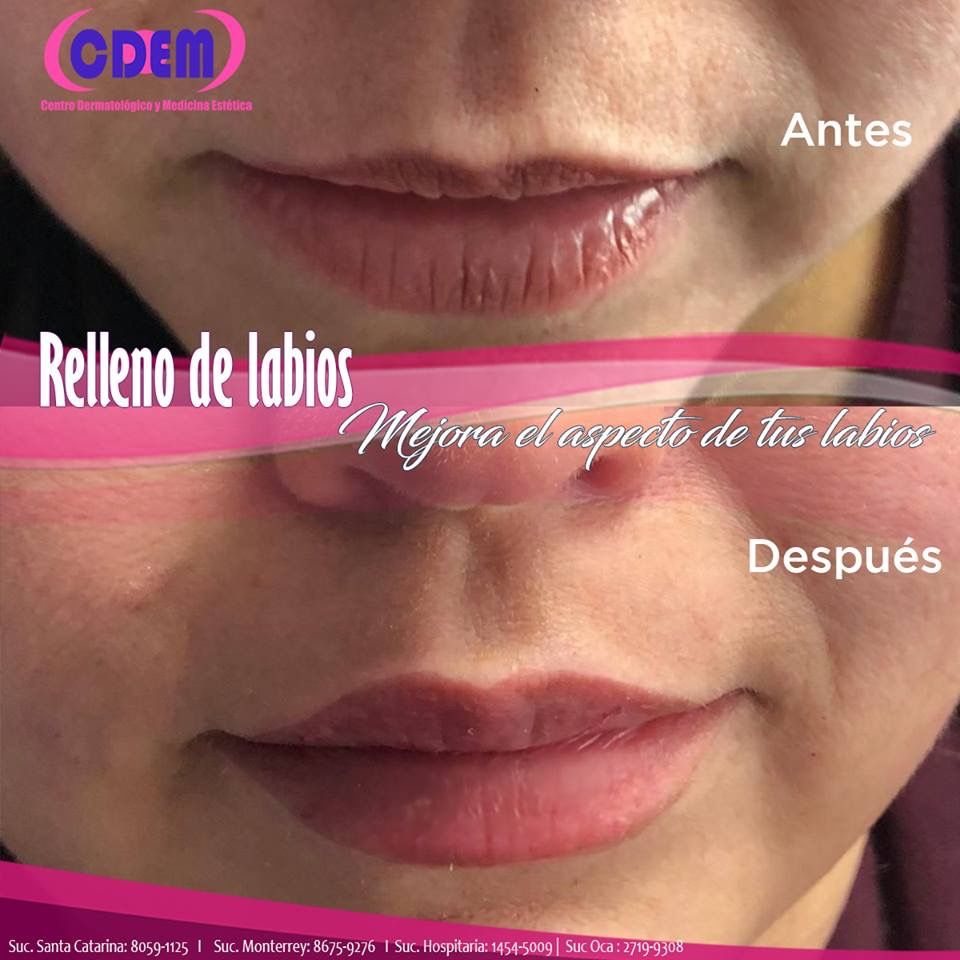 Mercedes Fernández Reyes-22