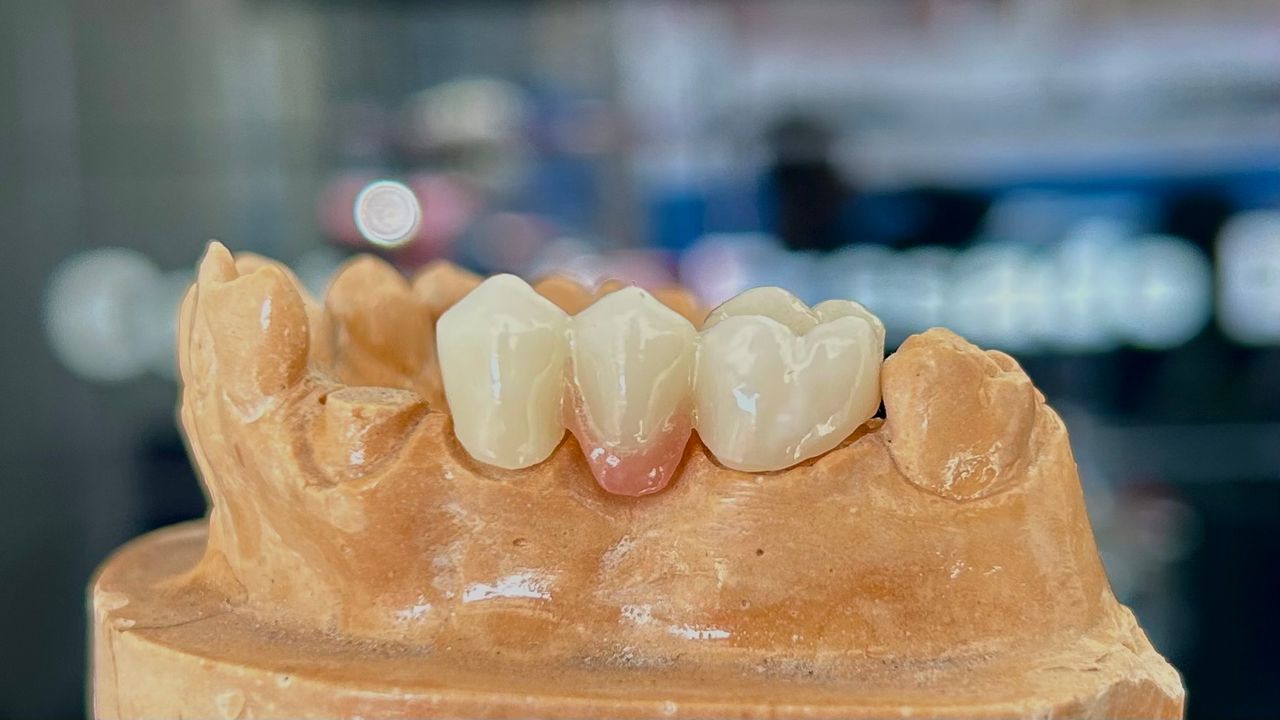 Solyenitzin Herrera Miron-10