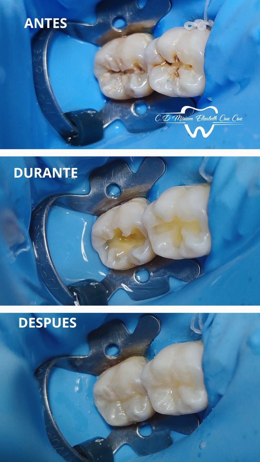 Miriam Elizabeth Cruz Cruz-11