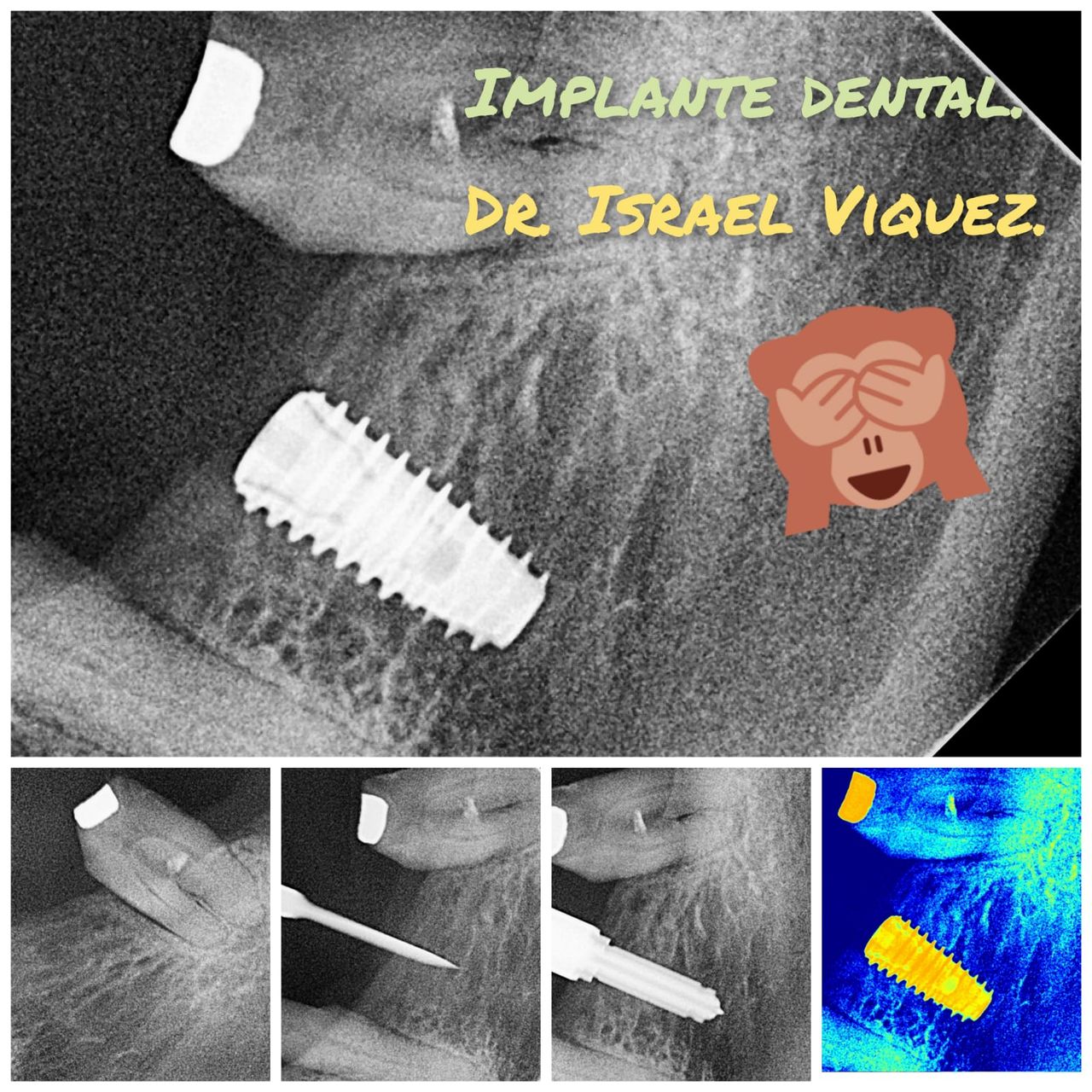 Israel Viquez Gomez-3