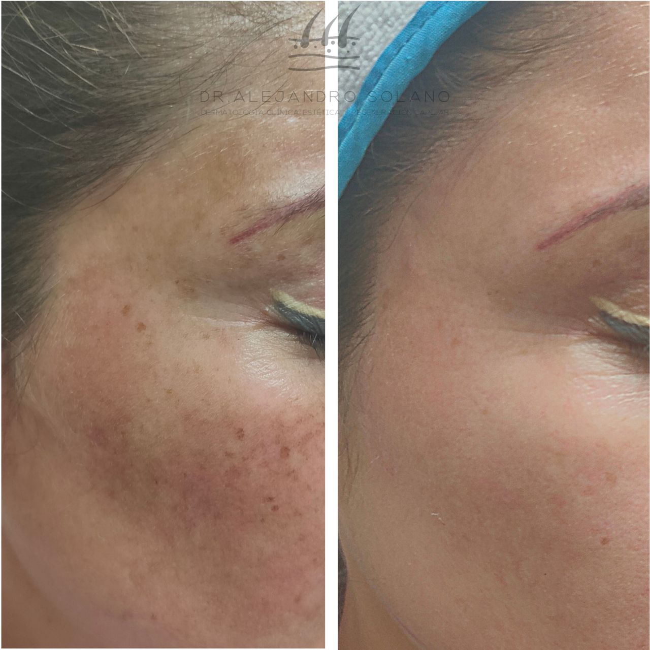 Oscar Alejandro Solano Anguiano-21