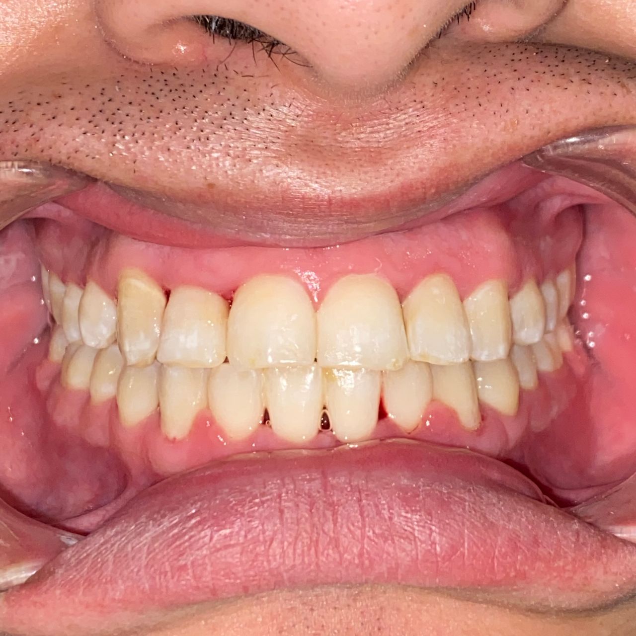 Raúl Méndez Cifuentes-2