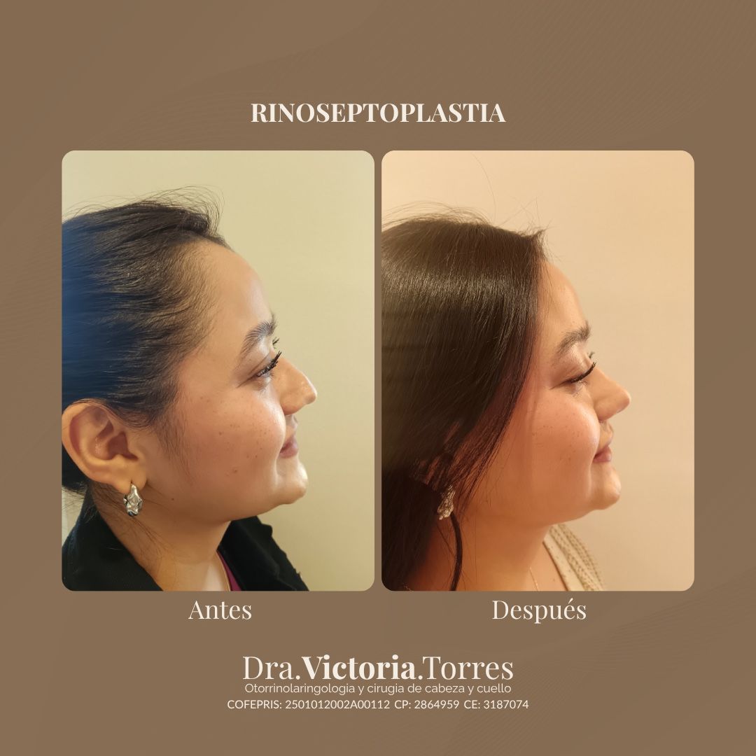 Estela Victoria Torres Galáz-8