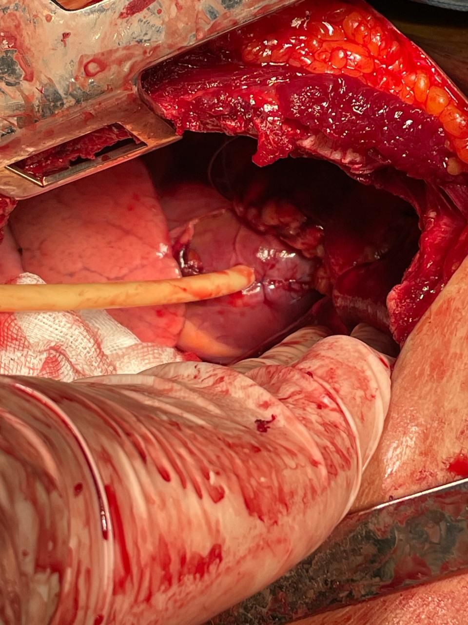 Joshua Saldaña Villanueva-2