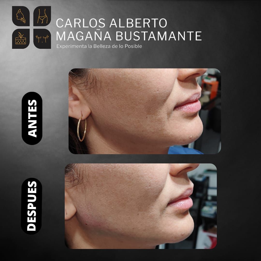 Carlos Alberto Magaña Bustamante-28