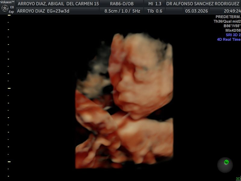 Alfonso Sanchez Rodriguez-51