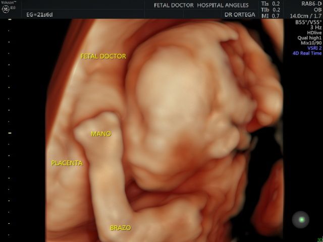 Jesús Manuel Ortega Flores-5