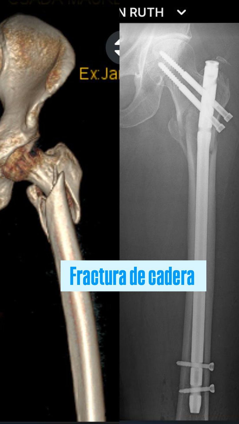 Juan Pablo Torres Nilo-5