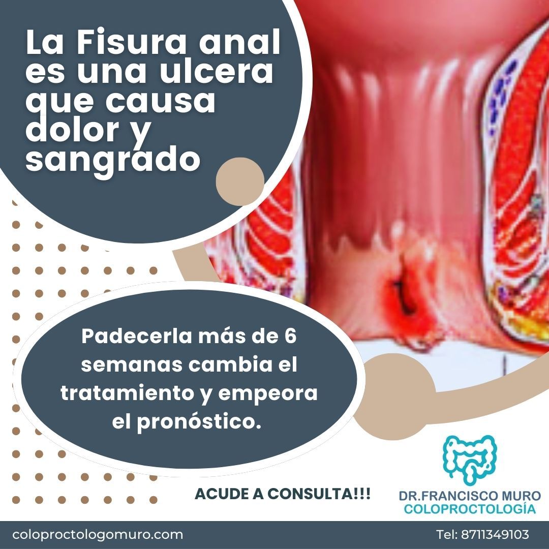 Juan Francisco Muro Ibarra-8