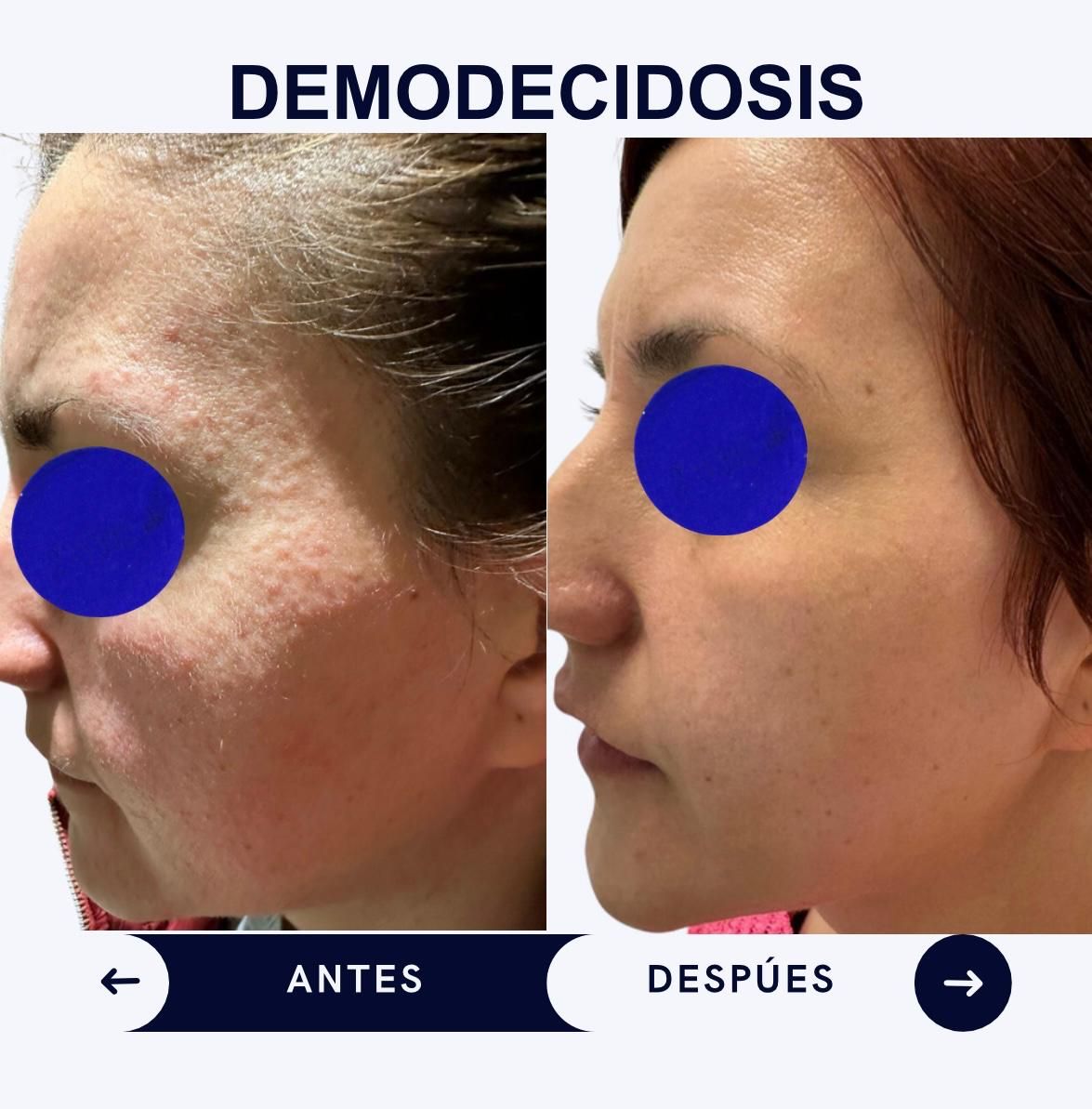 Itzel Anayn Flores Reyes-35