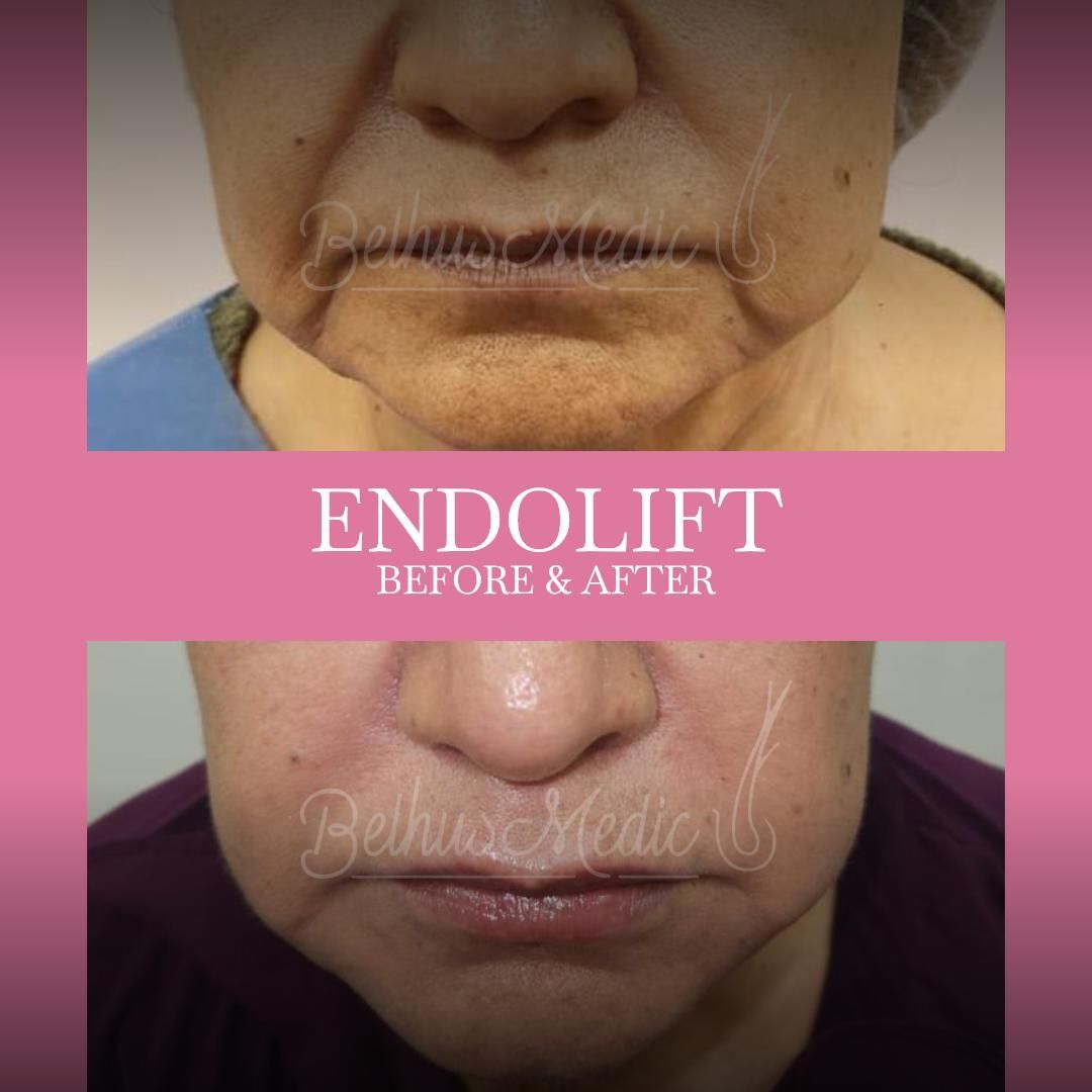 Alejandra Soriano Elorza-84