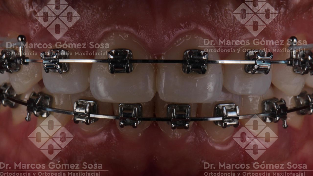 Marcos Gómez Sosa-4