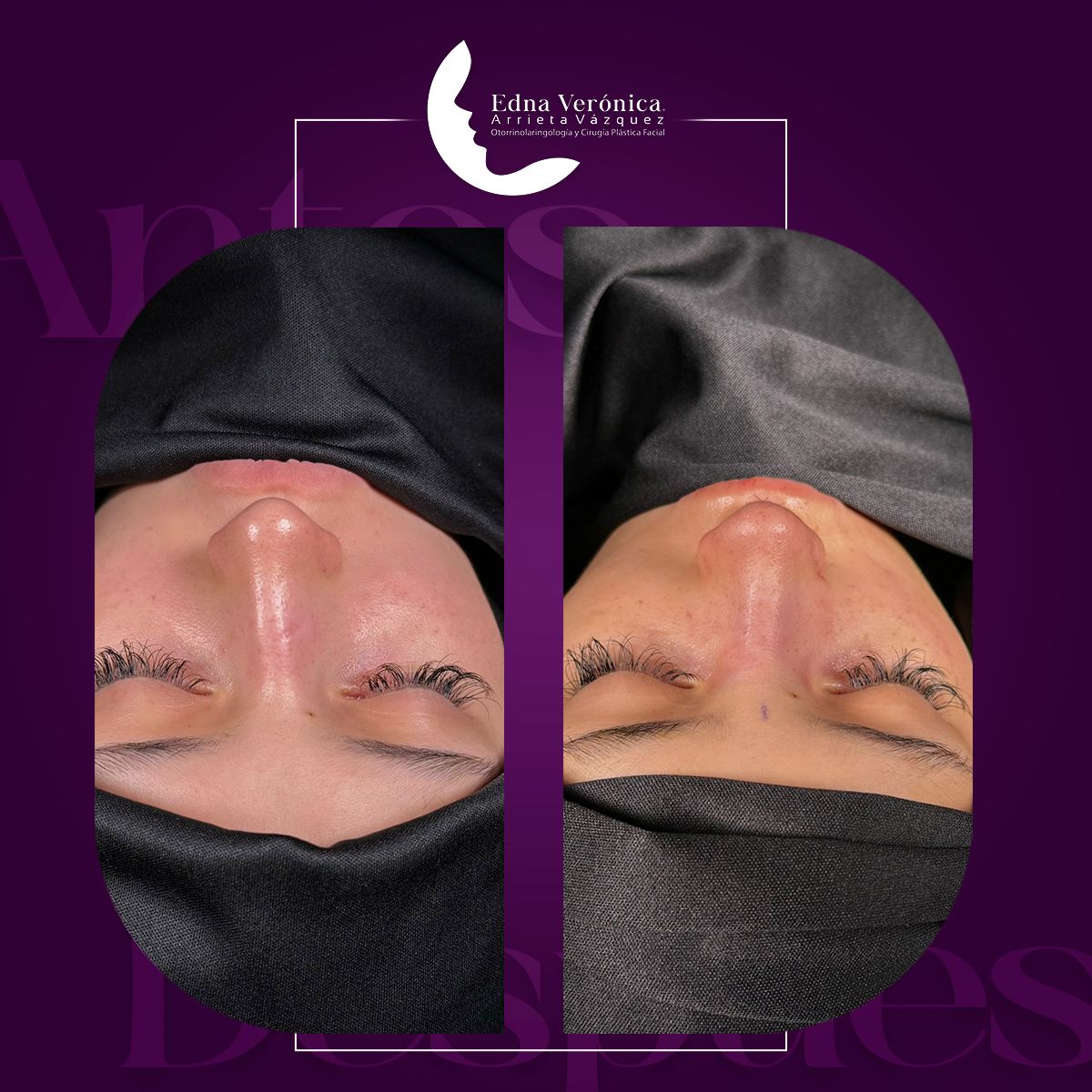 Edna Verónica Arrieta Vázquez-0