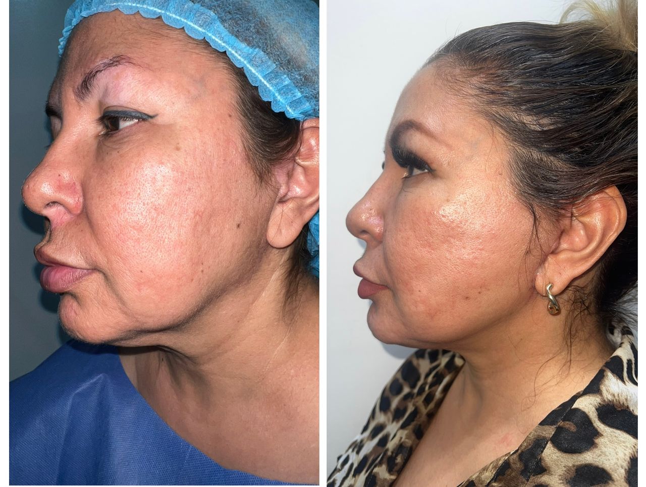 Guillermo Jiménez Labora Irineo-5