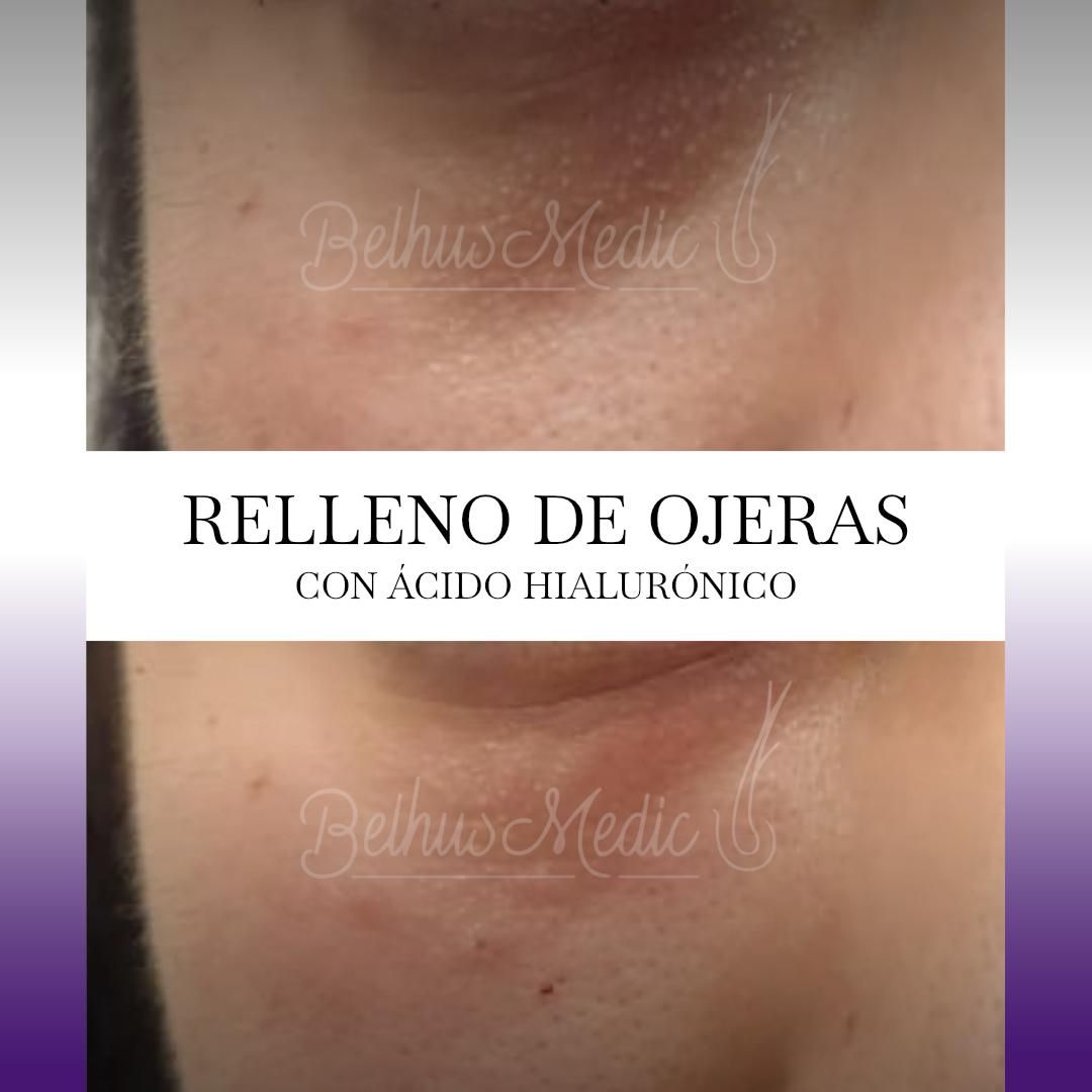 Alejandra Soriano Elorza-91