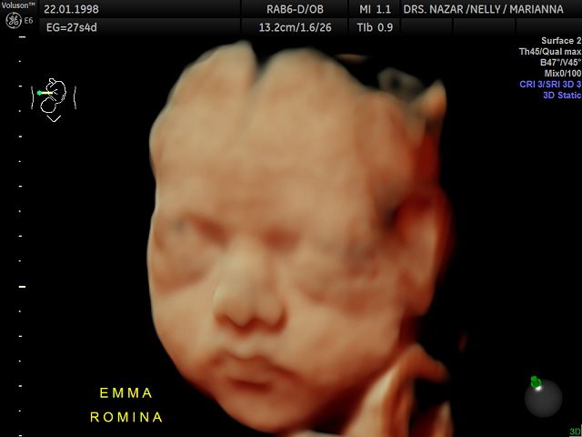 Miguel Angel González Nazar-17