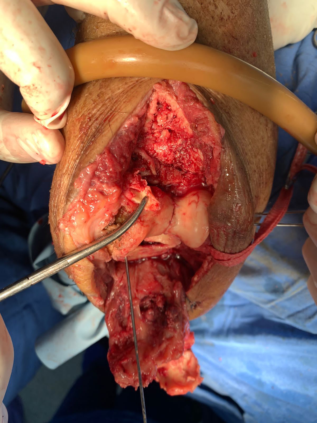 Francisco Sandoval Pérez-15