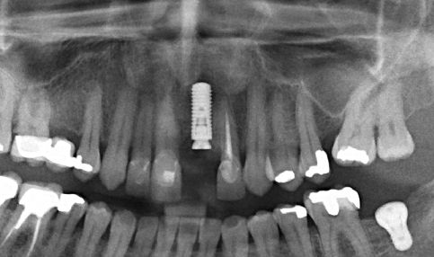 Juan José Castro Mosqueda-0