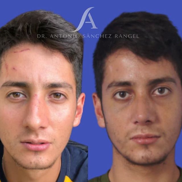 Antonio Sánchez Rangel-3