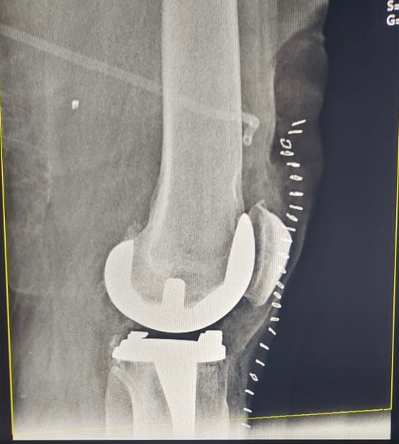 Josmar Adrián Lopez Eng-6