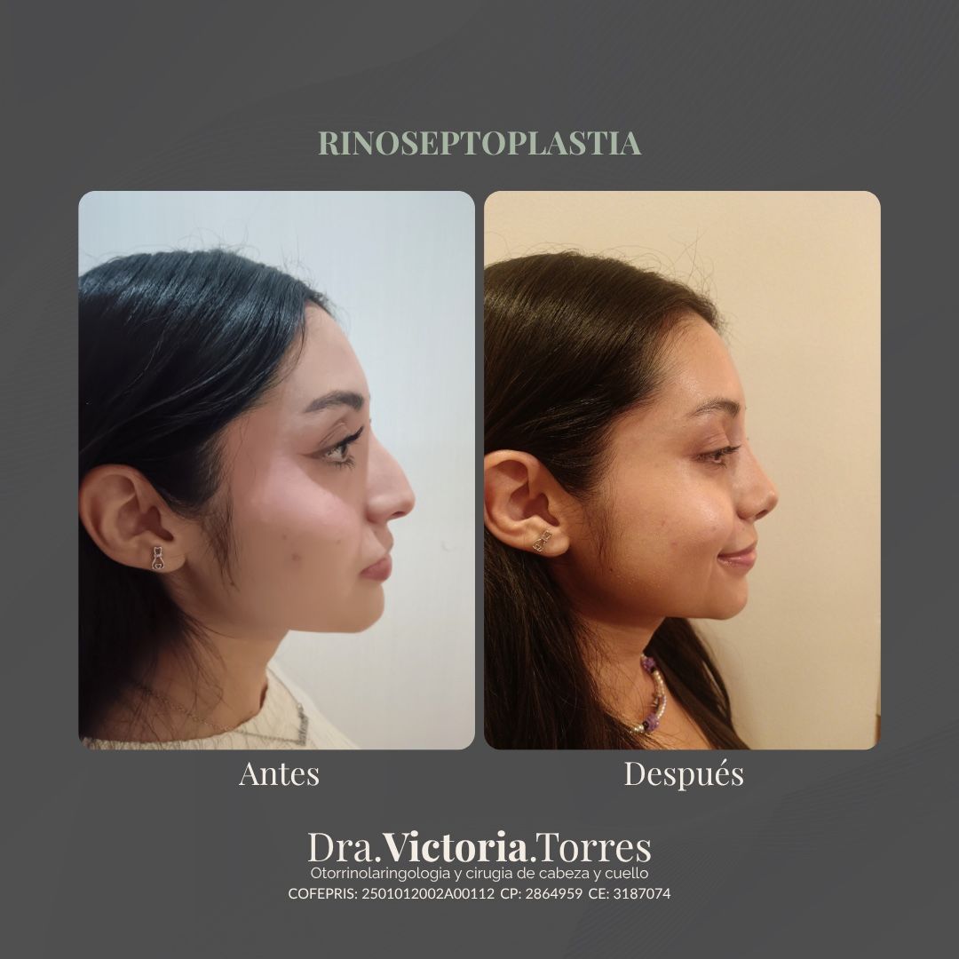 Estela Victoria Torres Galáz-11