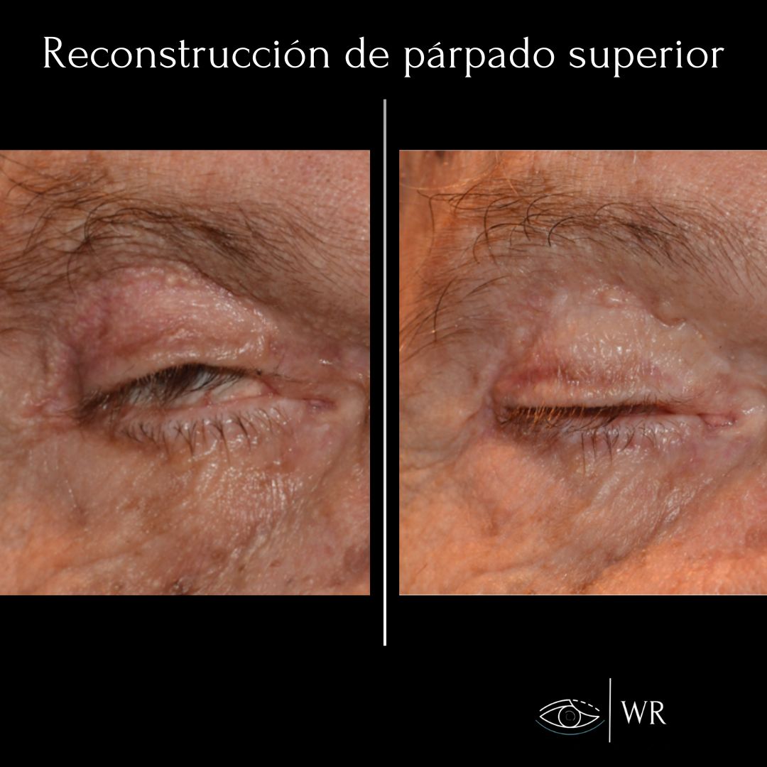 Wolfgang Rebollo Ramírez-3