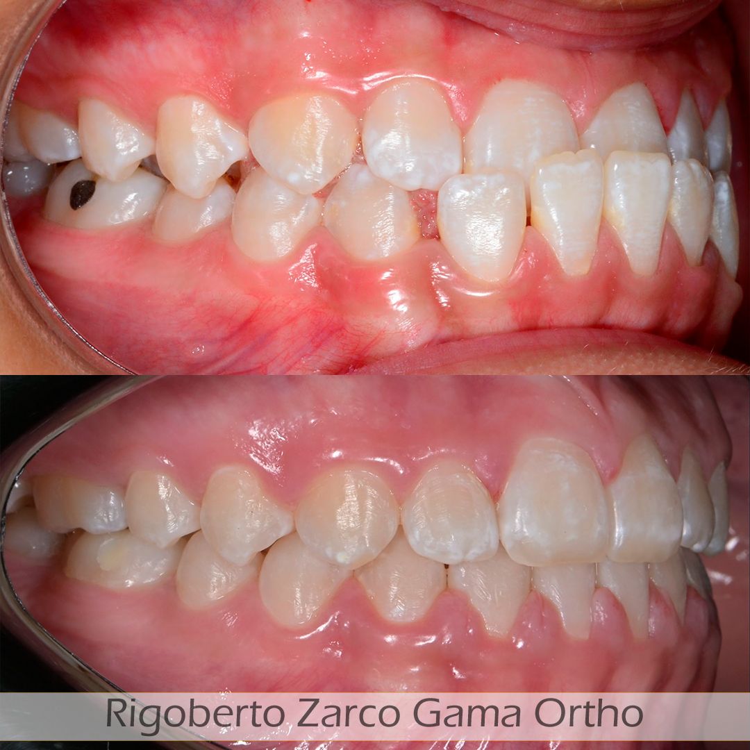 Rigoberto  Zarco Gama-5