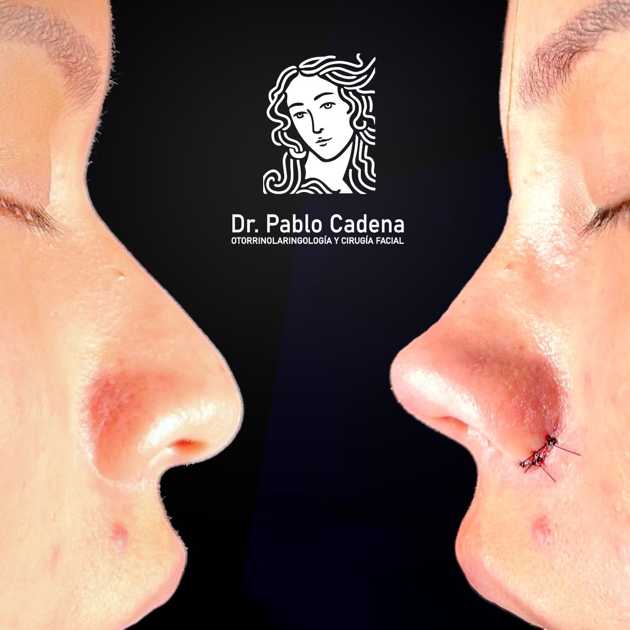 Juan Pablo Cadena Calderón-4