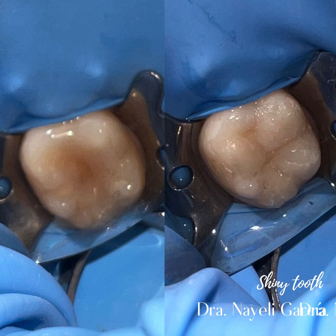 Nayeli Garcia Morales-30