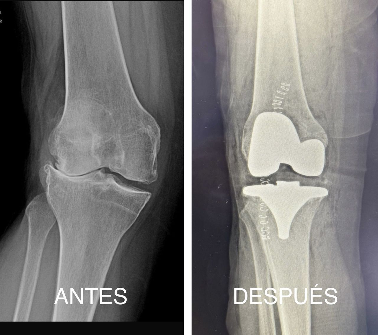 Luis Miguel Pacheco-0