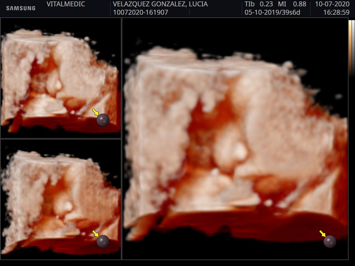 Monserrat Ramírez Penilla-2