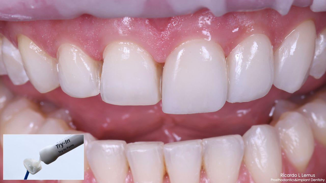 Ricardo López Lemus-115