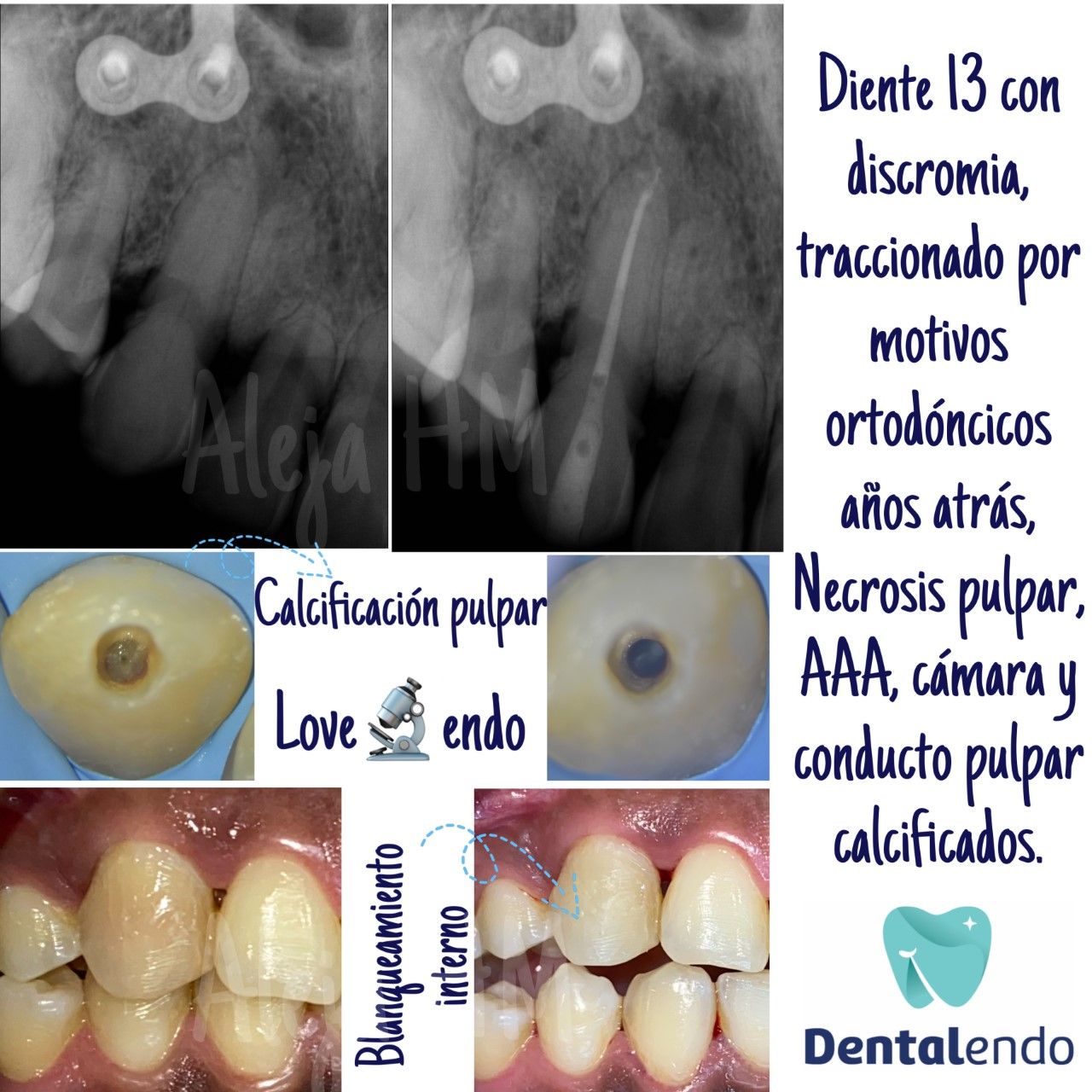 Alejandra Heredia Morán-4