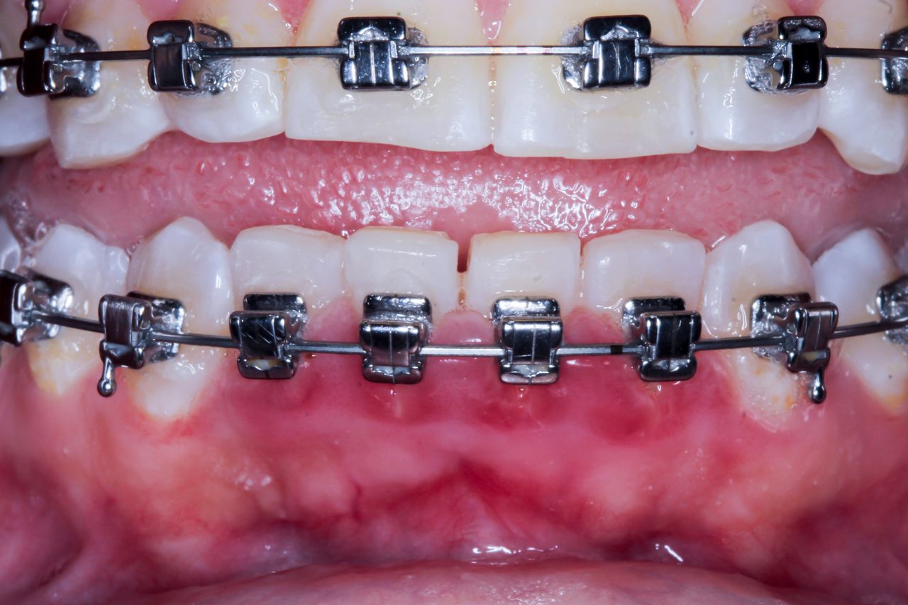 Hugo Enrique Aguilar Lamas-104