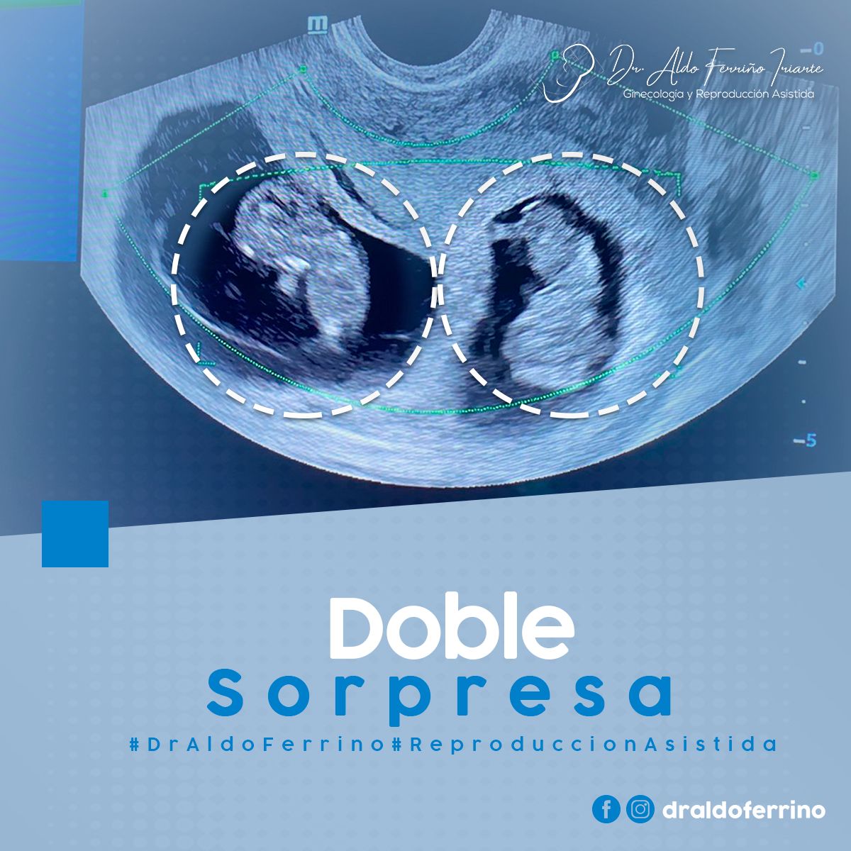 Aldo Ferriño Iriarte-2