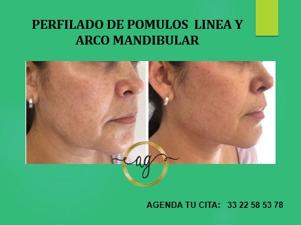 Alicia Gallo Cabrera-10