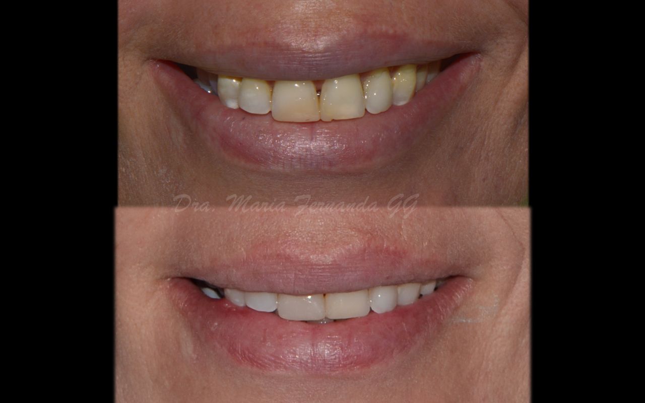 María Fernanda González Gastelum-11