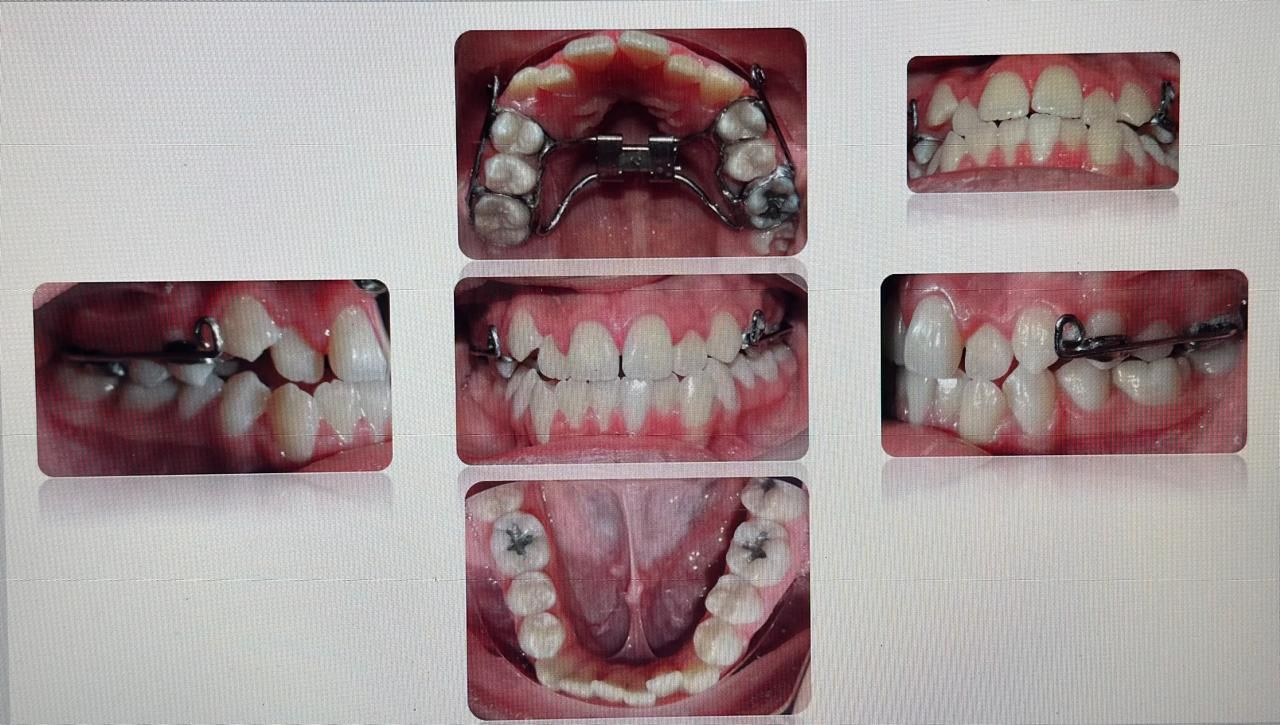 Antonio Gomez Arenas-9