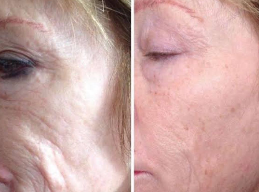 Samuel Torres Torres-13