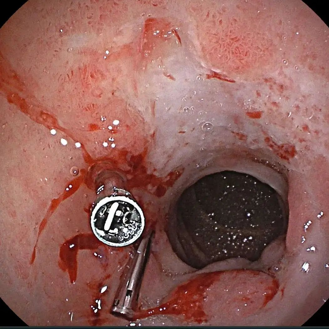 Edgar Alan De León Rojas-20