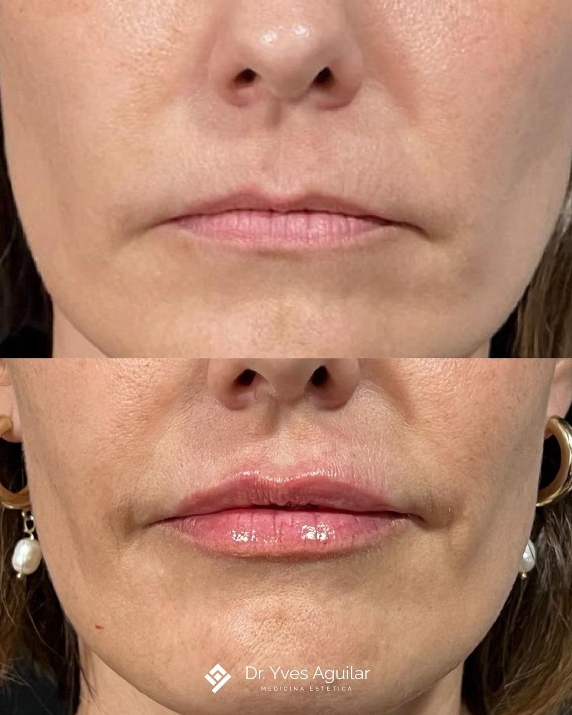 Yves Aguilar Fernández-7