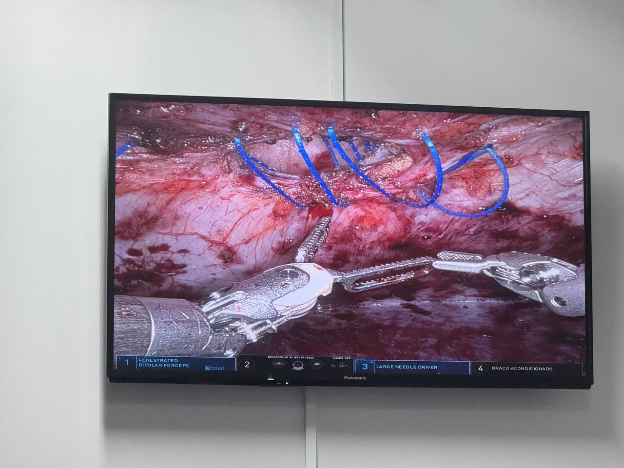 Diego Edwuin Rosales Carmona-23