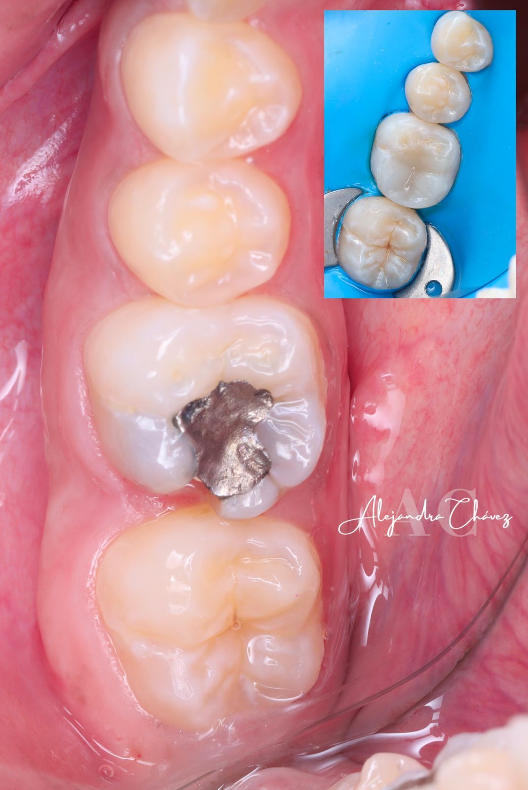 Alejandra Sujey Chávez Rodríguez-31