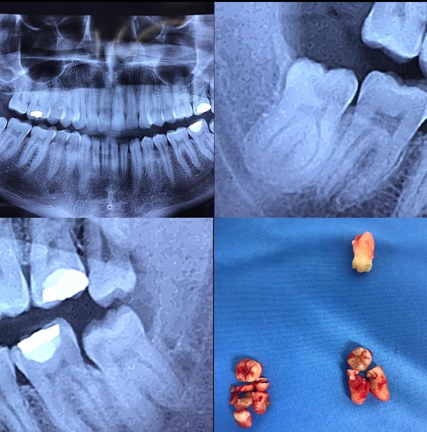 Guillermo García Garduño-18