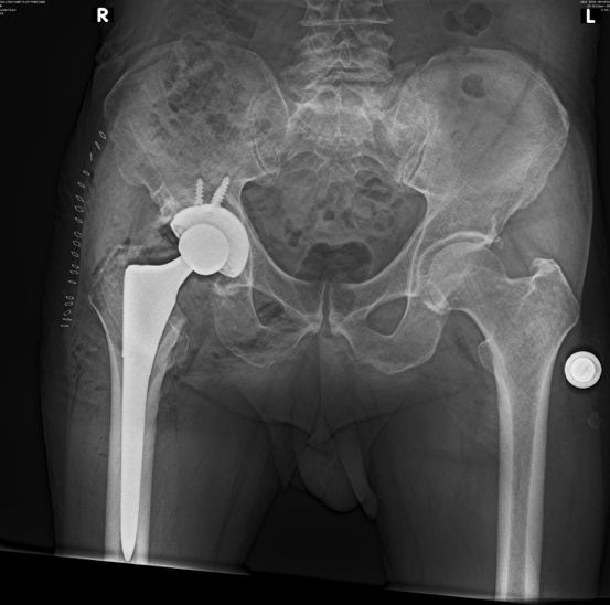 Fernando Ortiz Romero-17